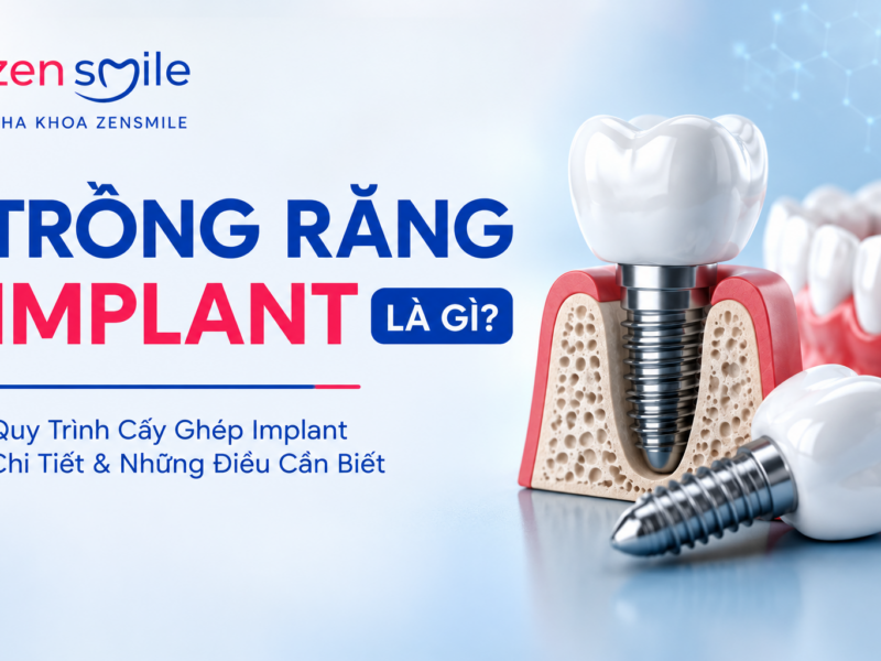 Trồng Răng Implant Là Gì? Quy Trình Cấy Ghép Implant
