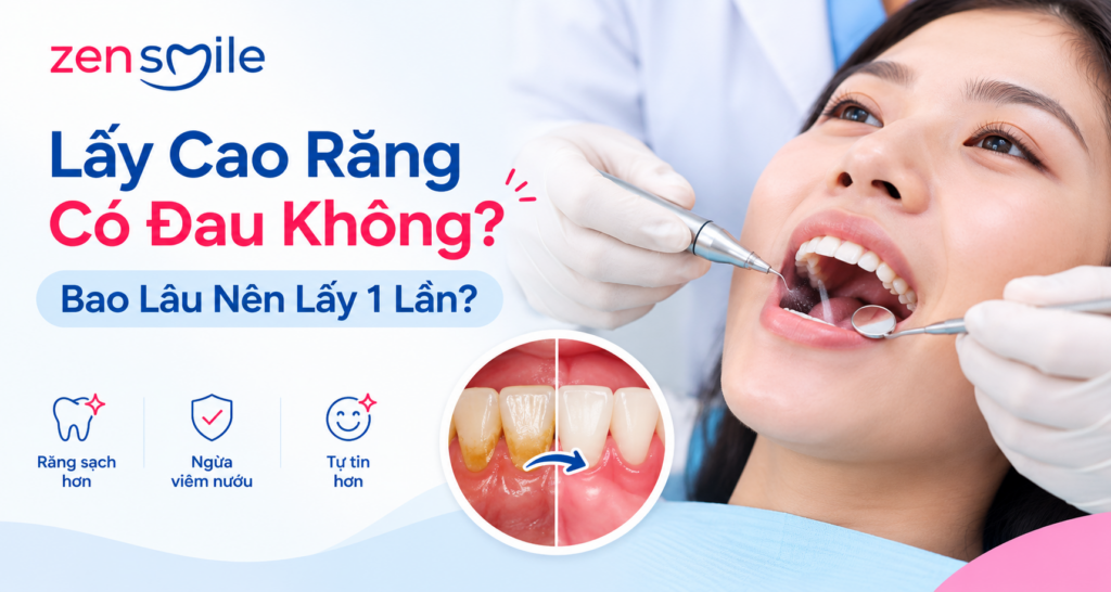 Lấy Cao Răng Có Đau Không?