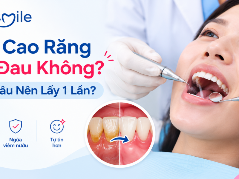Lấy Cao Răng Có Đau Không?