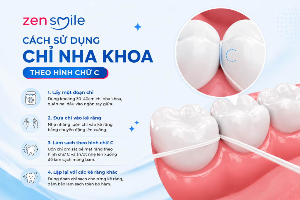 Cách chăm sóc răng miệng bằng chỉ nha khoa