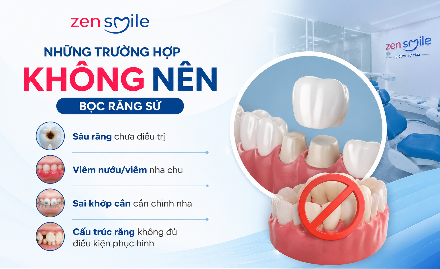 Những trường hợp nào không nên bọc răng sứ?