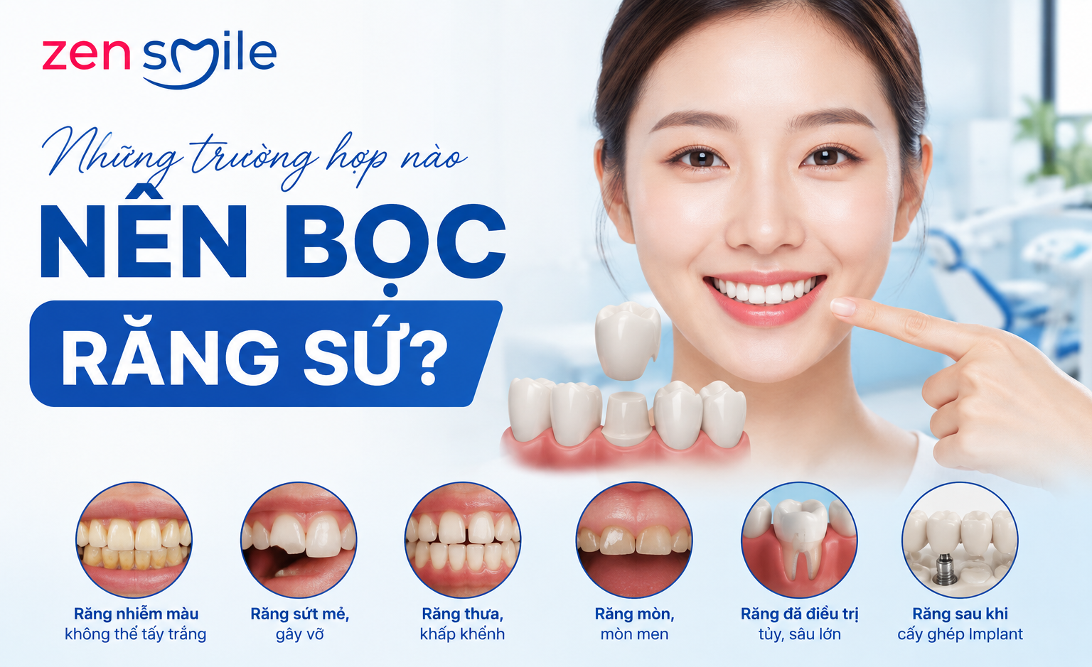Những trường hợp nào nên bọc răng sứ?