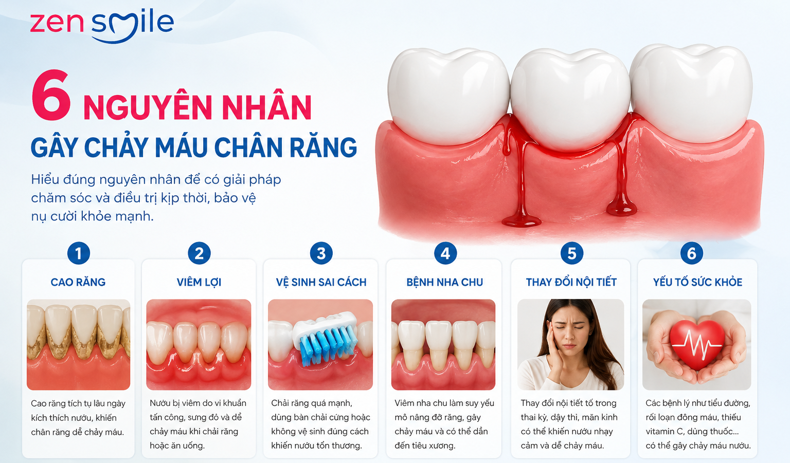Những nguyên nhân gây chảy máu chân răng thường gặp