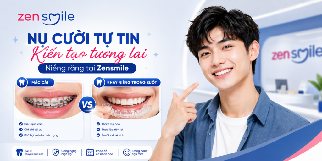 Niềng răng là gì và các phương pháp niềng răng phổ biến