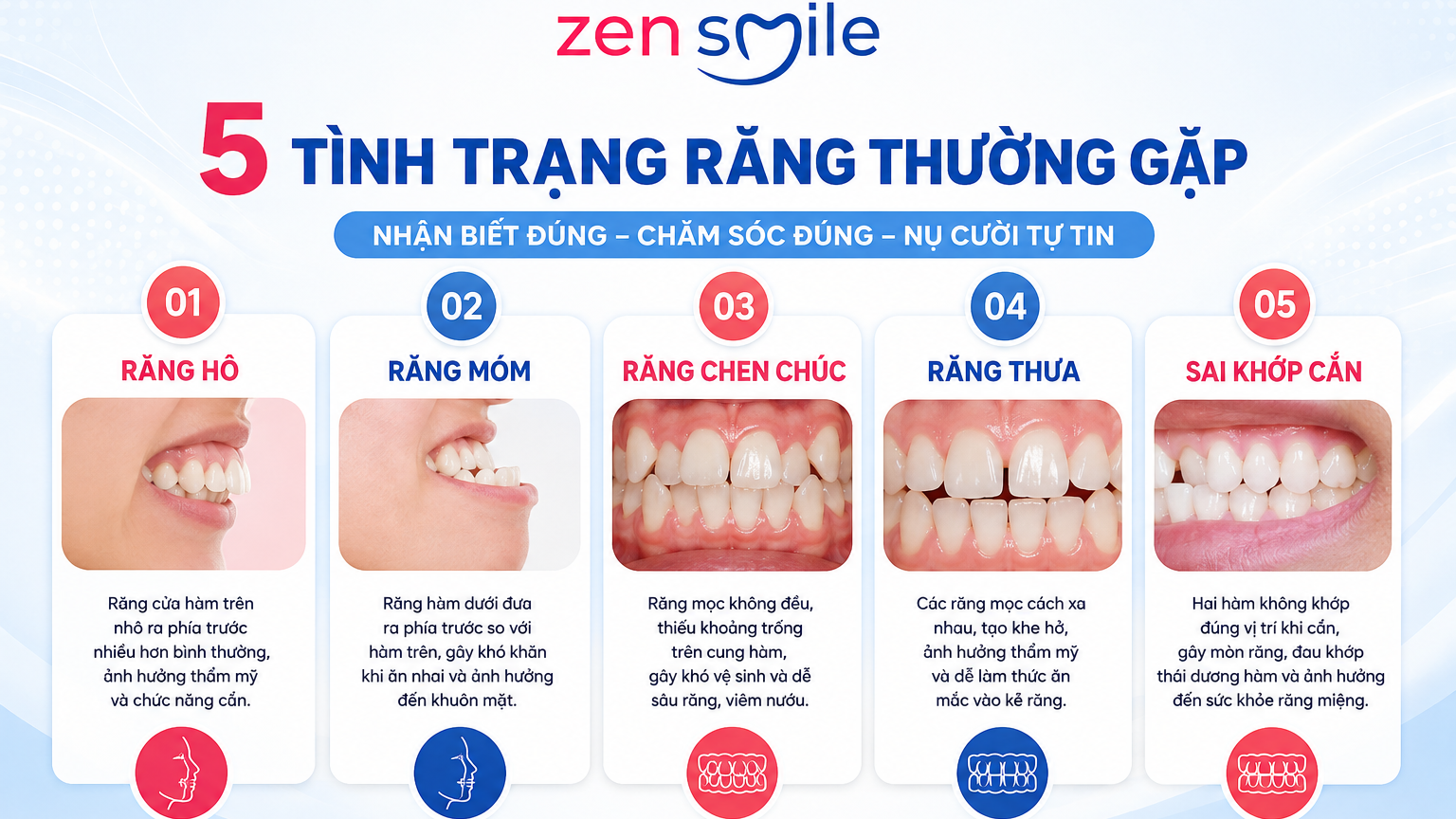 Các trường hợp có thể cần chỉnh nha niềng răng